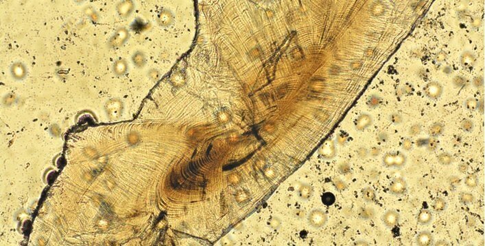 Juvenile yellow snapper (pargo amarillo) otolith at 10x magnification.